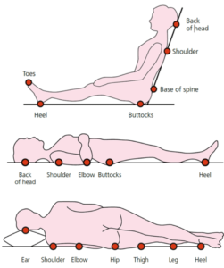 Pressure Ulcers 